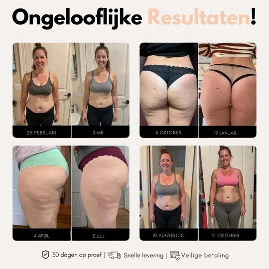 Legginsy 3D – Wzmocnij swoją sylwetkę i zmniejsz widoczność cellulitu